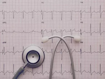Šta je EKG i šta pokazuje?
