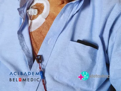 Šta je port i zašto se ugrađuje? Port je mali medicinski uređaj koji se hirurški ugrađuje ispod kože, najčešće na predelu grudnog koša.