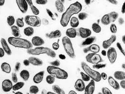 Coxiella burnetii je rikecija, koja je vrlo otporna u spoljnoj sredini. Rikecije su Gram negativne bakterije koje se razmnožavaju samo u živoj ćeliji osetljivih domaćina.