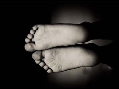 Dijabetesno stopalo je jedna od mnogobrojnih komplikacija šećerne bolesti i predstavlja skup koštanih i mekotkivnih promena na stopalu.