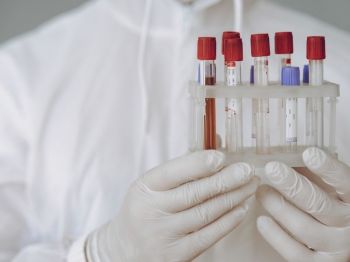 Tumačenje laboratorijske analize krvi