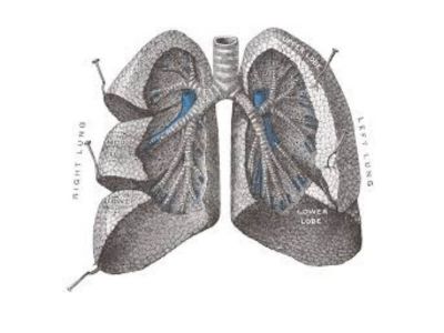 Akutni respiratorni distres sindrom (ARDS) odraslih osoba klinički je sindrom akutne respiratorne insuficijencije, odnosno akutnog plućnog edema. Nastaje usled oštećenja parenhima pluća i manifestuje se bilateralnom plućnim infiltratima, teškom i refrakternom hipoksemijom i teškom dispnejom, zbog redukcije plućne komplijanse.